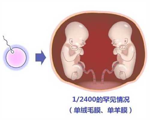 代孕医生咨询，做试管婴儿前，需要输卵管结扎吗?