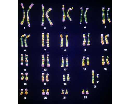 〔宝宝先天性泪眼堵塞〕,做三代试管婴儿多少费用？